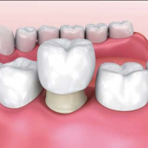 Rehabilitación Oral