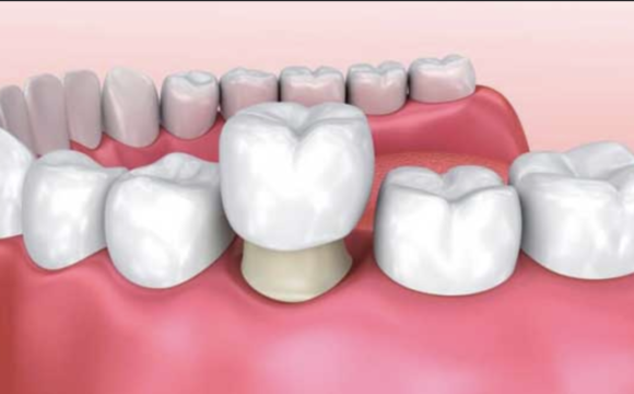 Rehabilitación Oral