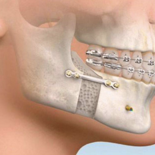 Cirugía Maxilofacial