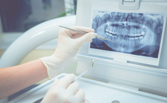 ¿Cómo se realiza un diagnóstico adecuado en Ortodoncia?